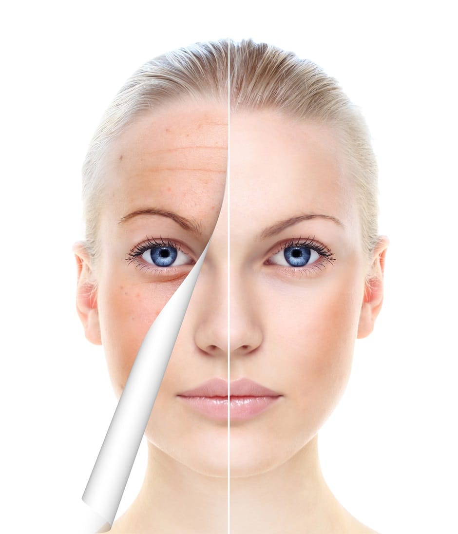 Anti aging