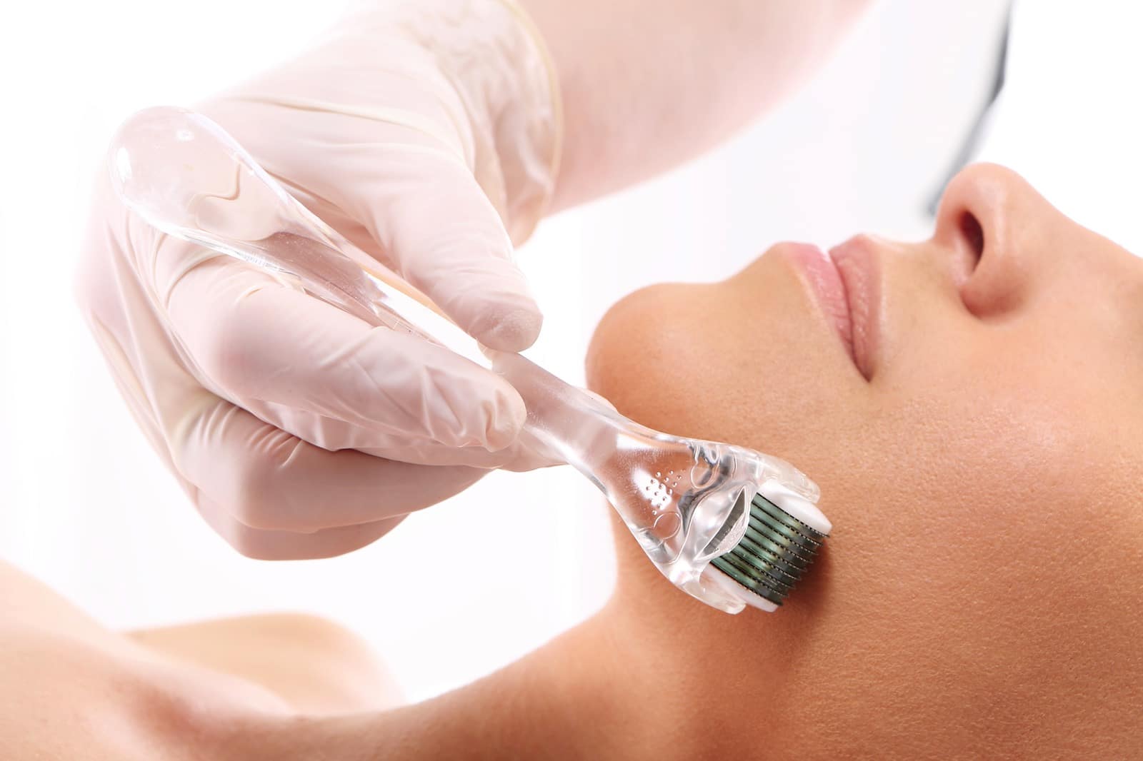 Dermaroller Microneedling